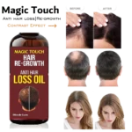 Magic Touch Hair Regrowth Oil