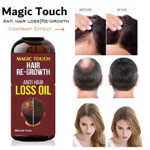 Magic Touch Hair Regrowth Oil