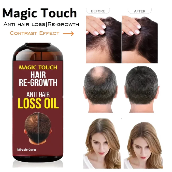 Magic Touch Hair Regrowth Oil