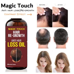 Magic Touch Hair Regrowth Oil 