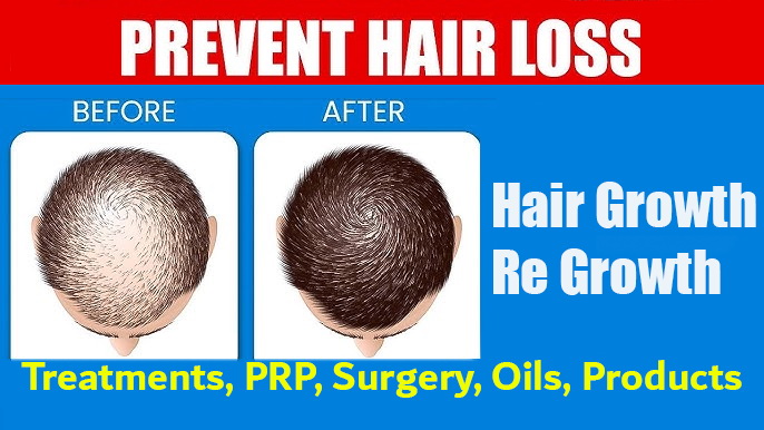 The Science of Hair Loss: How to Prevent & Regrow Lost Hair