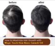 Before and after results of Magic Touch hair growth oil after 4 weeks