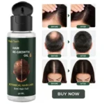 Magic Touch Hair Regrowth Anti Hair Loss Oil 50ml bottle